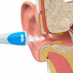 Urządzanie do czyszczenia uszu z końcówkami w zestawie 16 szt